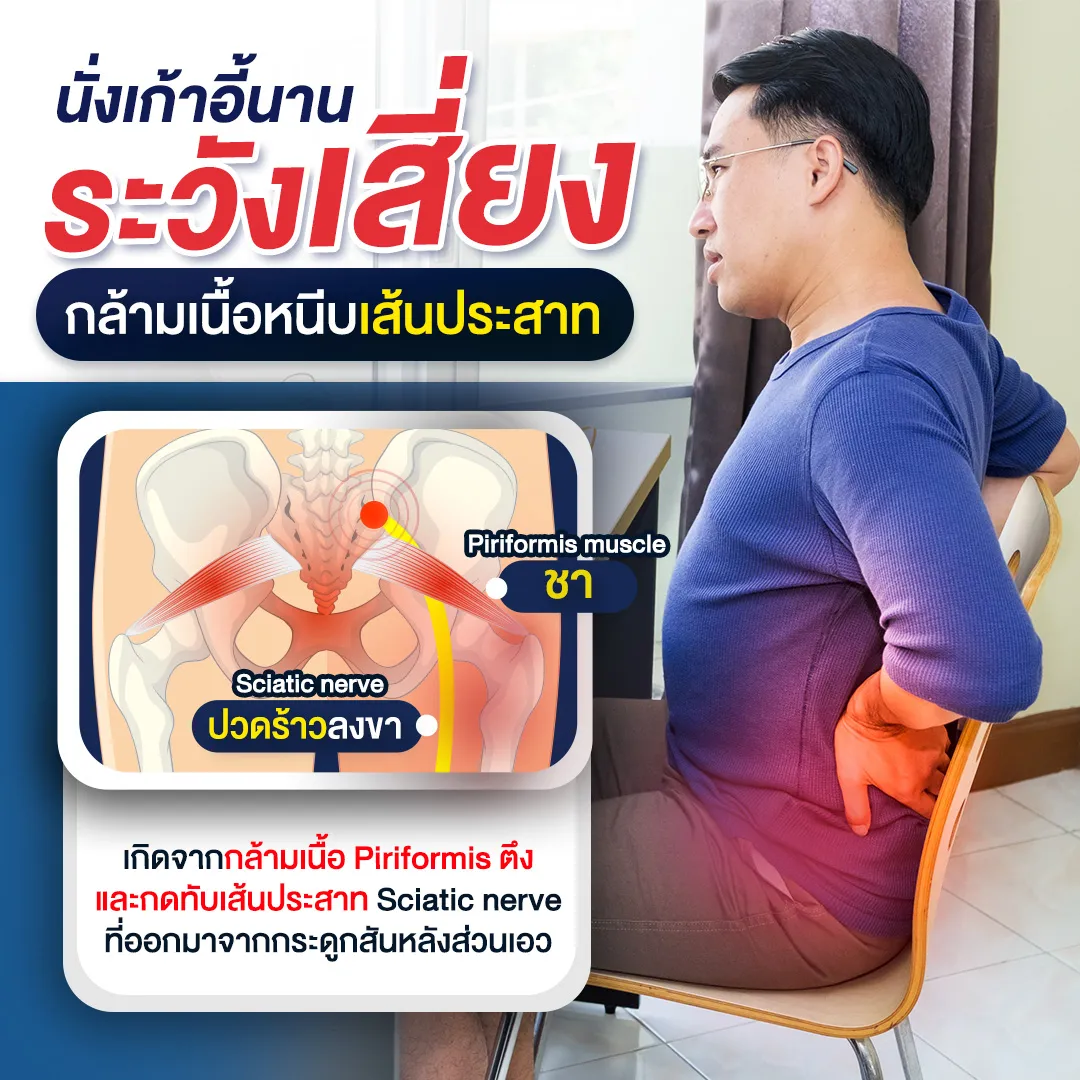 นั่งเก้าอี้นาน ระวังเสี่ยงกล้ามเนื้อหนีบเส้นประสาท