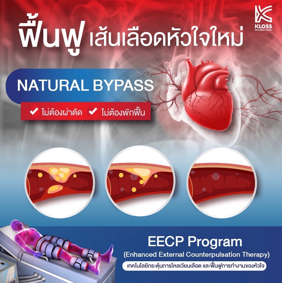 EECP Therapy  คุ้มไหม ? กับทางเลือกใหม่สำหรับผู้ป่วยโรคหัวใจ