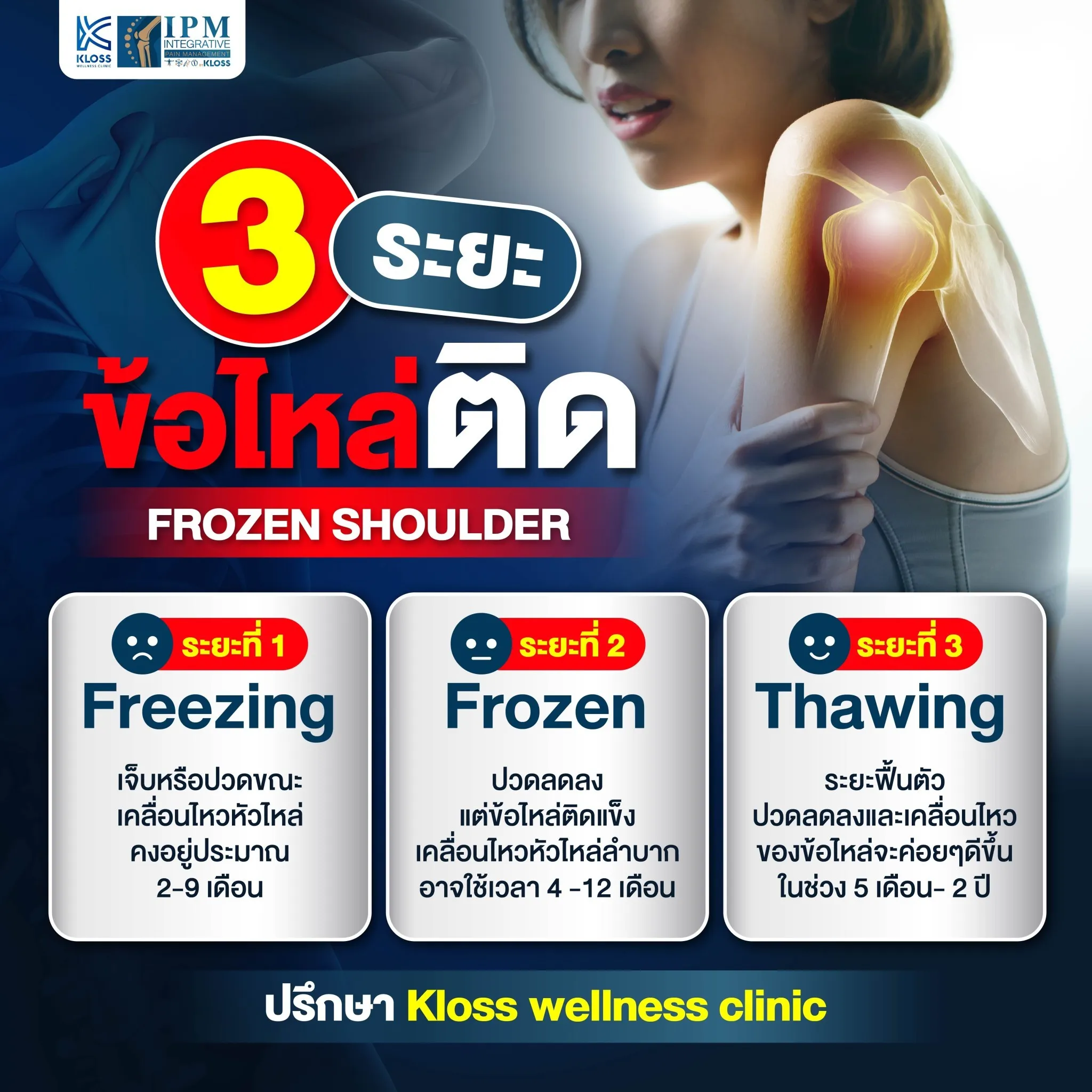 ข้อไหล่ติด….โรคยอดฮิตวัยทำงาน