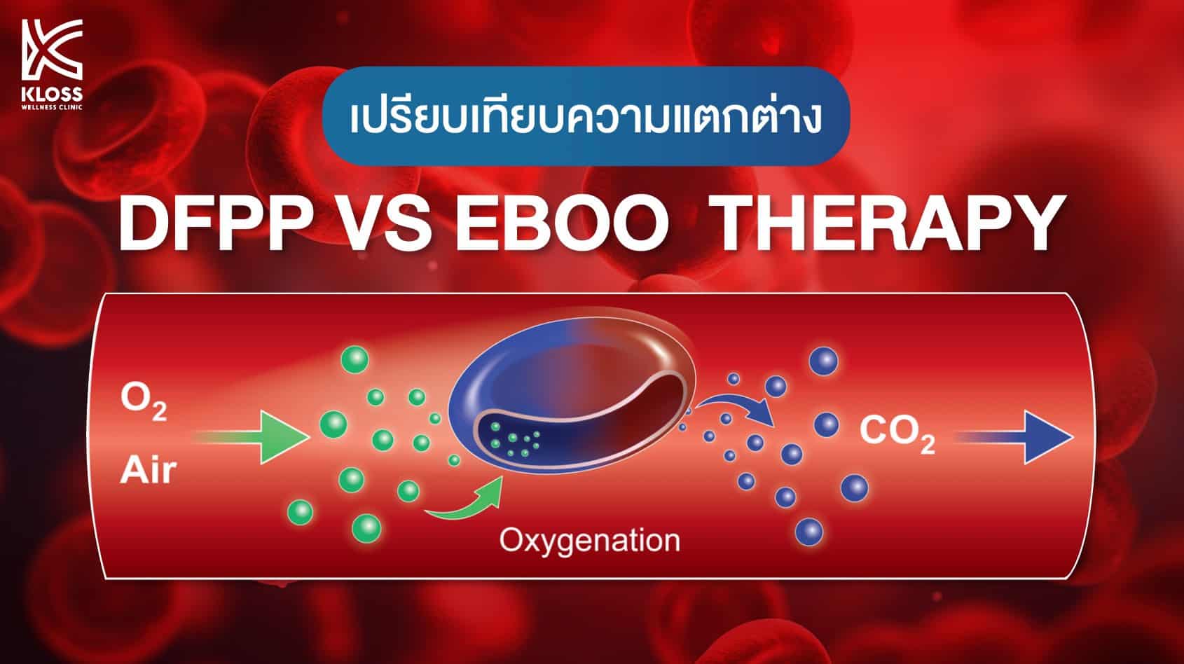 เปรียบเทียบโปรแกรม DFPP กับ EBOO
