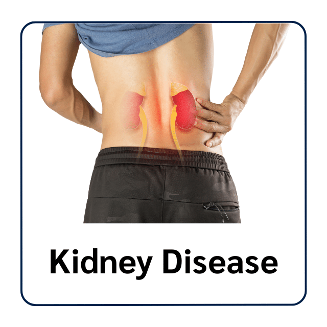 ภาพแสดงตำแหน่งไตบริเวณหลังส่วนล่าง สื่อถึงโรคไตและปัญหาการทำงานของไต